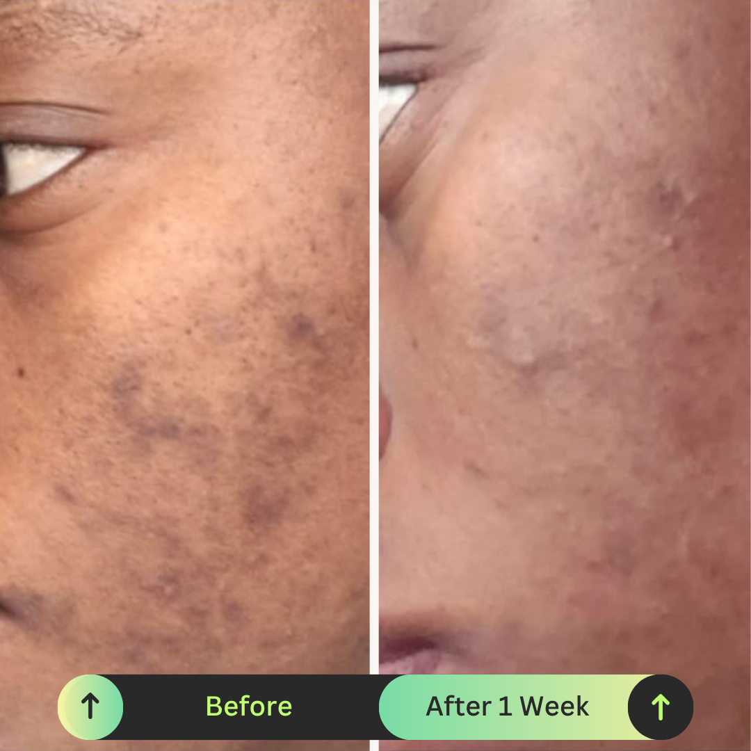 Ona Mae Skin Results