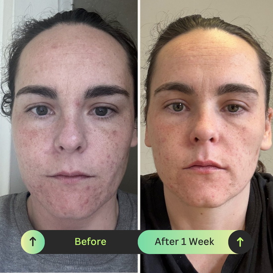 Ona Mae Skin Transformation