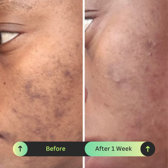 Ona Mae Skin Transformation