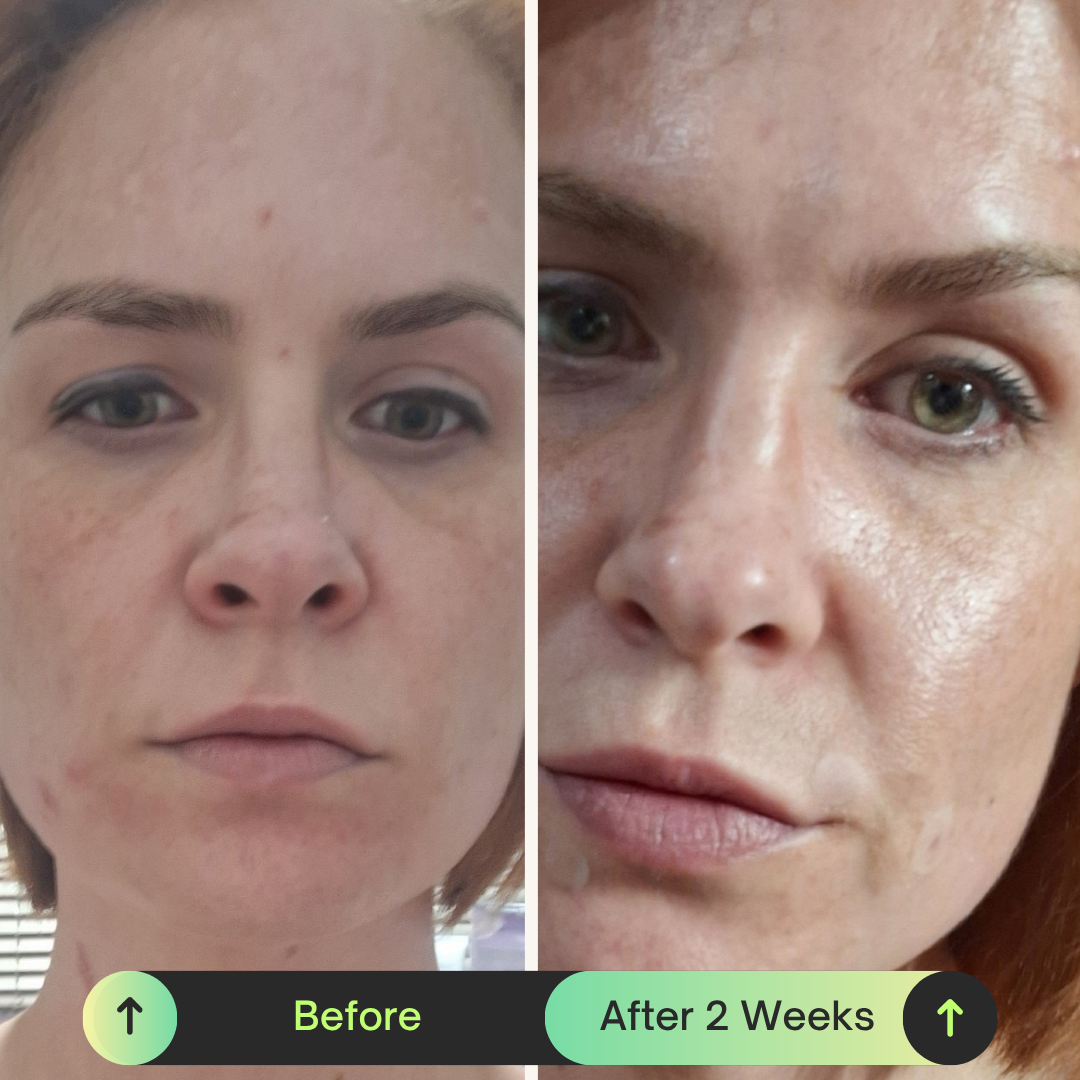 Supercharged 5% Vitamin C Serum