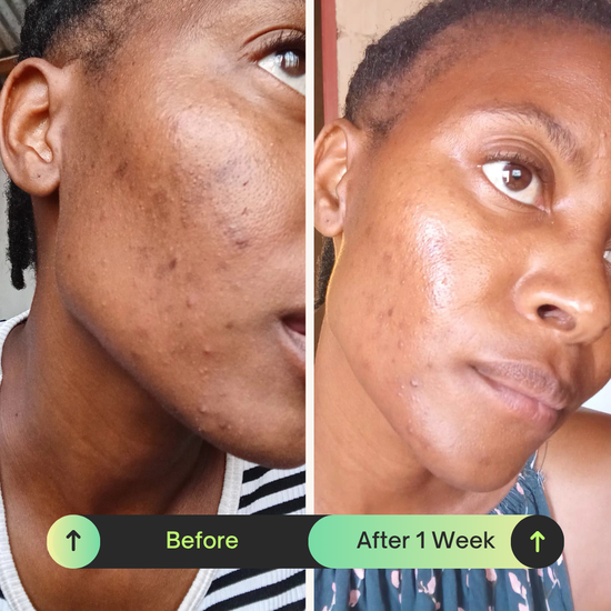 Ona Mae Skin Transformation
