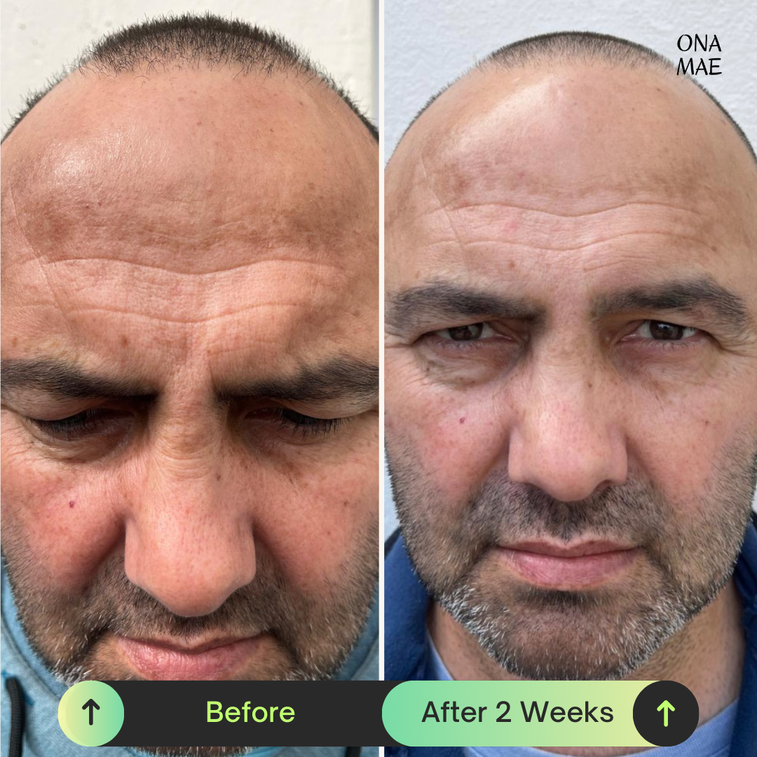 Ona Mae Skin Results