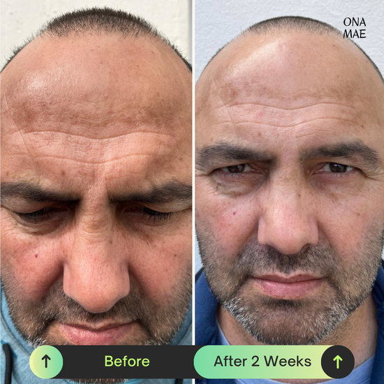 Ona Mae Skin Results