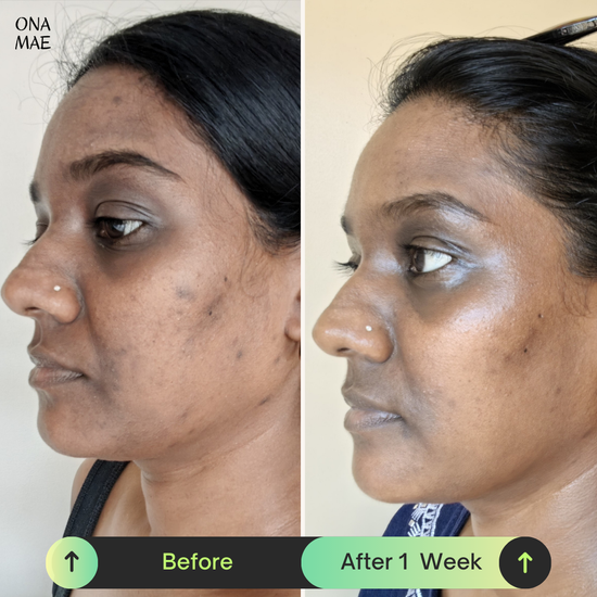 Ona Mae Skin Results