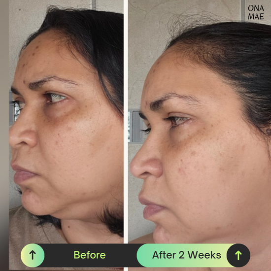 Ona Mae Skin Results