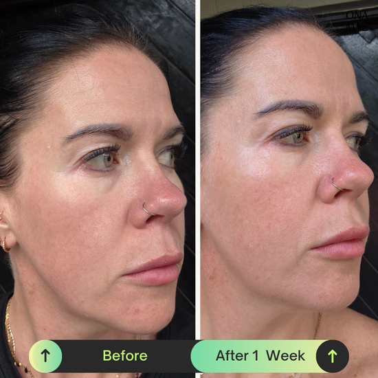 Ona Mae Skin Results