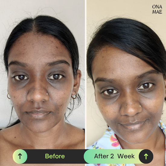 Ona Mae Skin Results