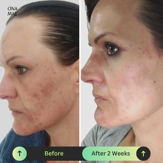 Ona Mae Skin Results