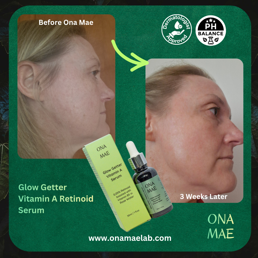 Before and after comparison of a woman's face with Ona Mae serum, showing visible improvement.