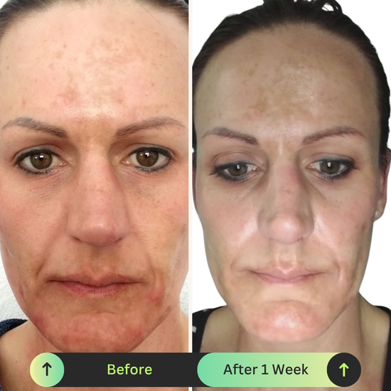 Ona Mae Skin Transformation