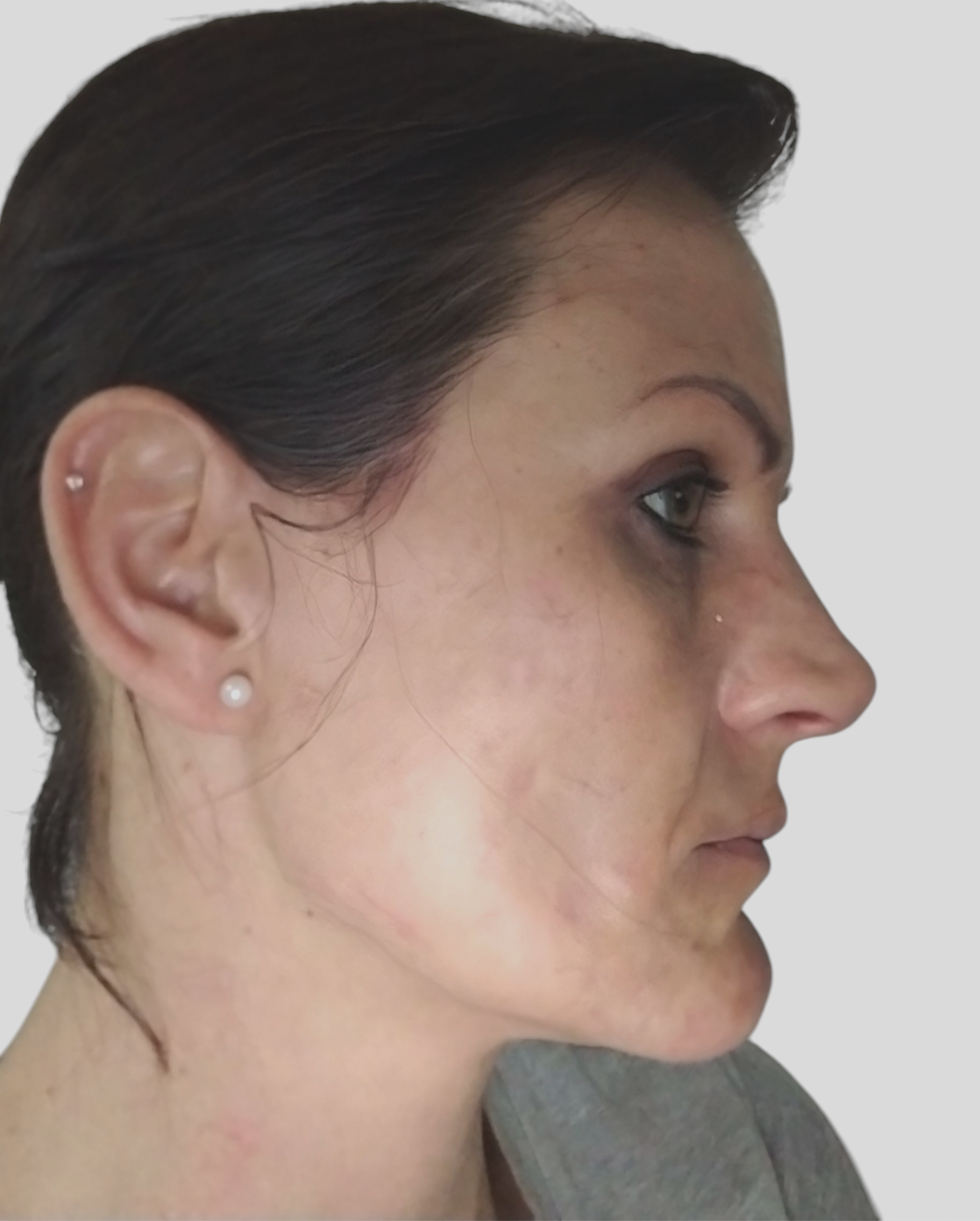 Woman's face, close up - healthy skin
